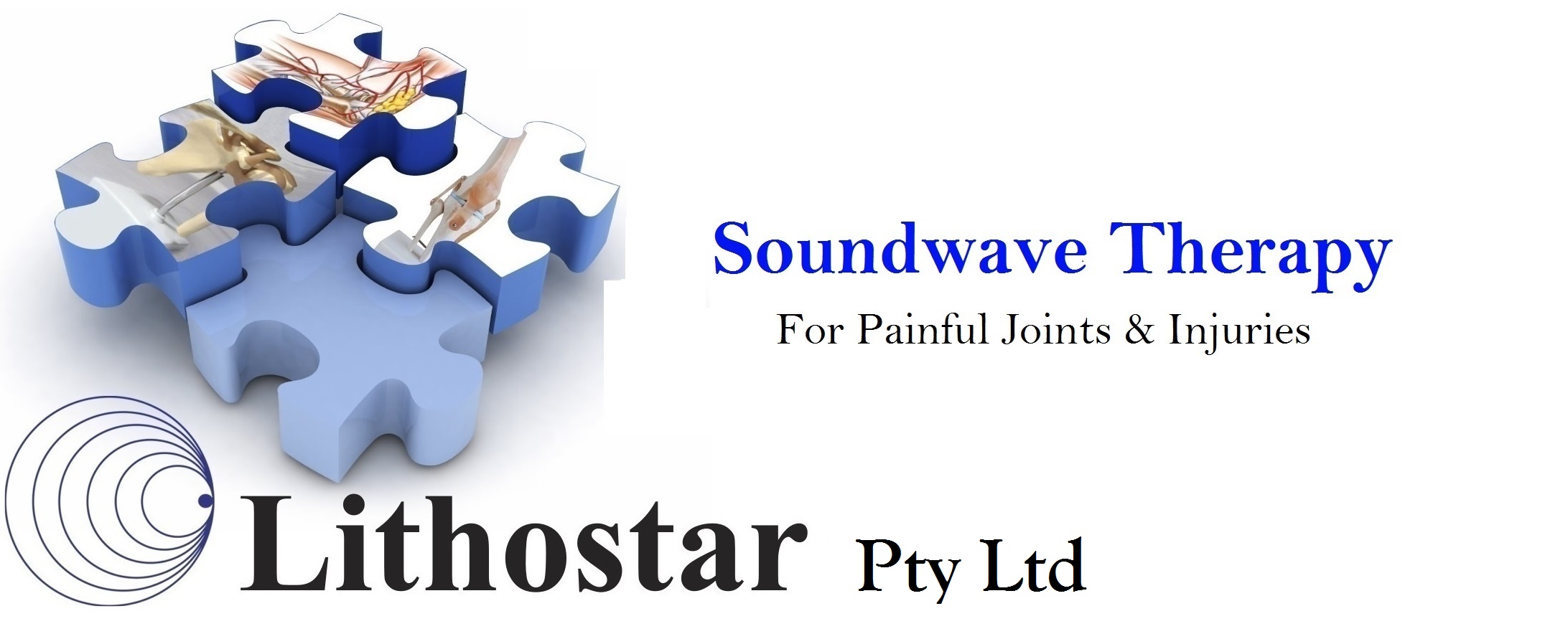 LithostarLogo